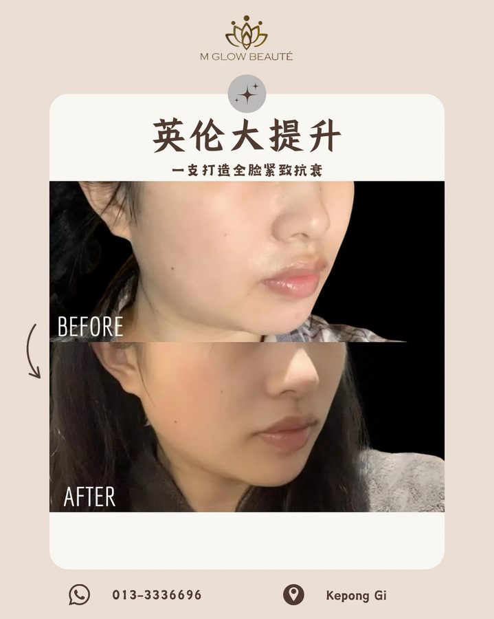 英伦大提升前后